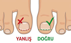 TIRNAK KESİMİNDE NELERE DİKKAT EDİLMELİDİR?