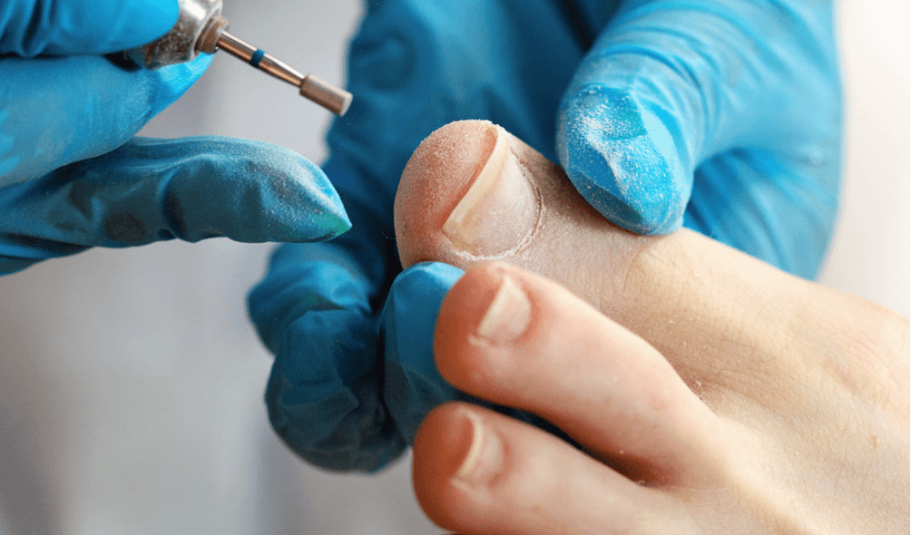 Medikal Ayak Bakımı